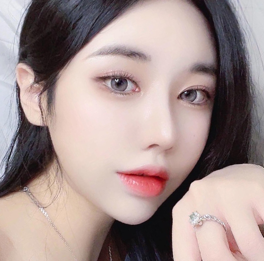 눈매교정 수술 후