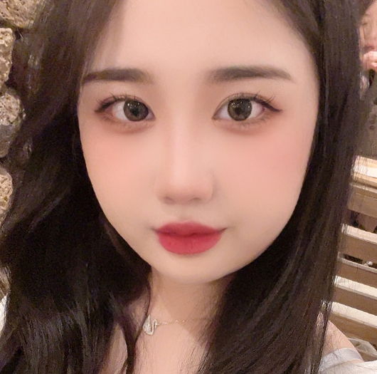 눈매교정 수술 후