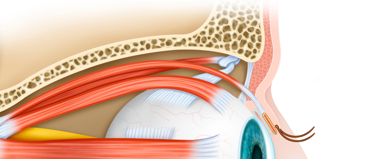 졸린 눈의 근본적인 원인 해결! 눈 뜨는 근육의 힘 UP