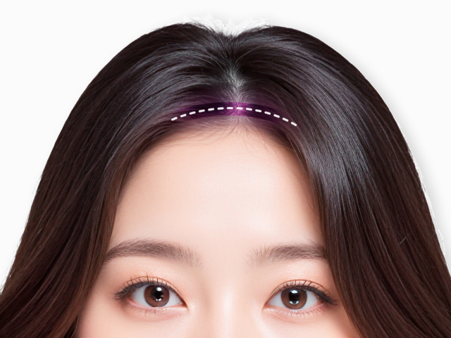 확실하고 견고한 고정! 다시 붙는 유착현상 방지