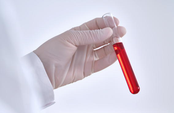 내 몸에서 찾은, 믿을 수 있는 안전함! 자가 혈액 유래 성분